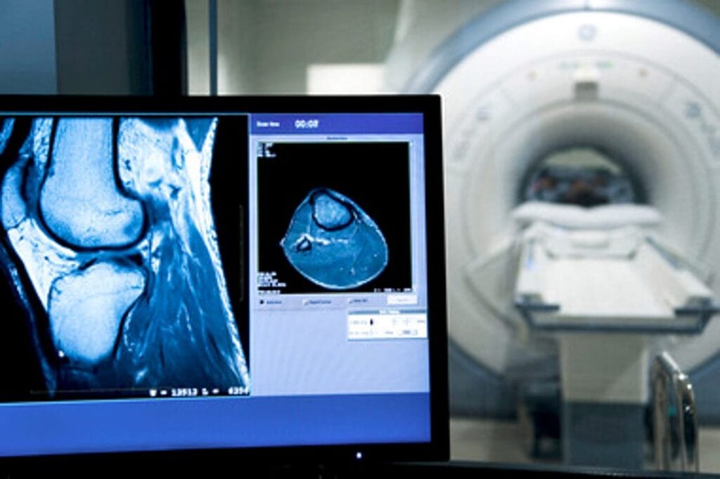 11wyXwWDm8IYuEJ4p92oYTQ